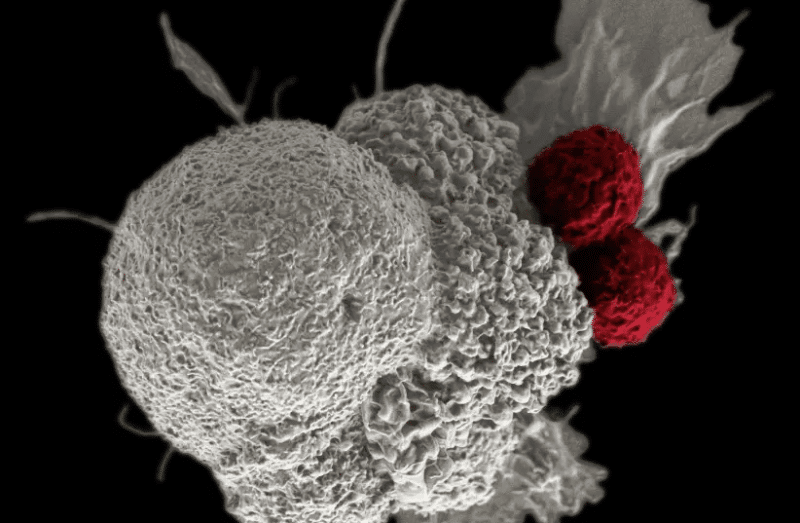 Uimitorul caz al femeii care a supraviețuit 21 de ani deși avea cancer terminal