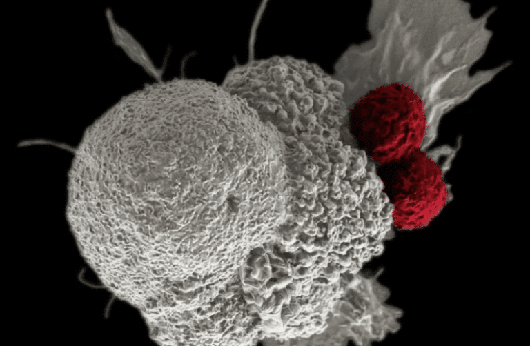 Leguma miraculoasă pentru prevenirea cancerului recomandată de un oncolog